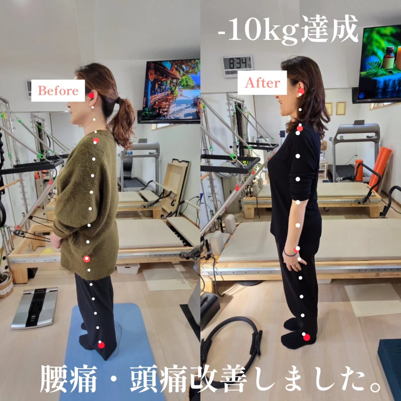 ダイエットコース－１０㎏成功
