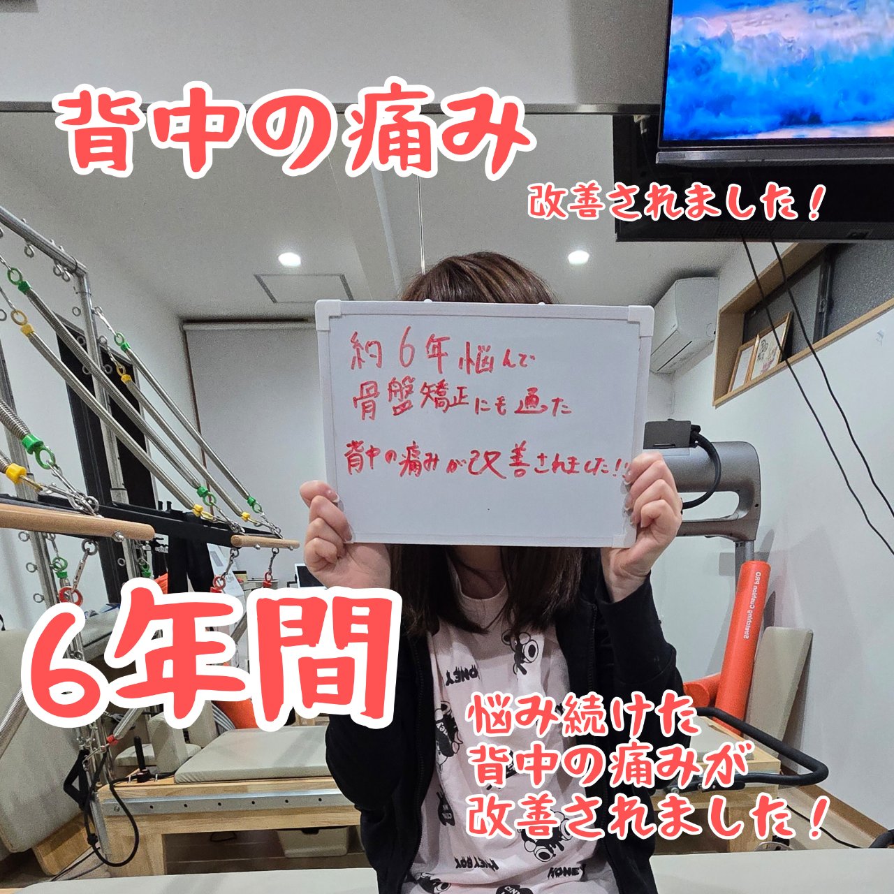 背中の張りと背中の痛み改善